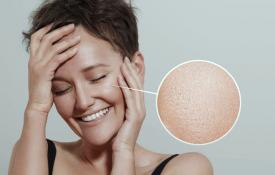 Mastna koža obraza: kako normalizirati delovanje žlez lojnic?